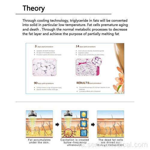 دستگاه لاغری Cryolipolysis قابل حمل